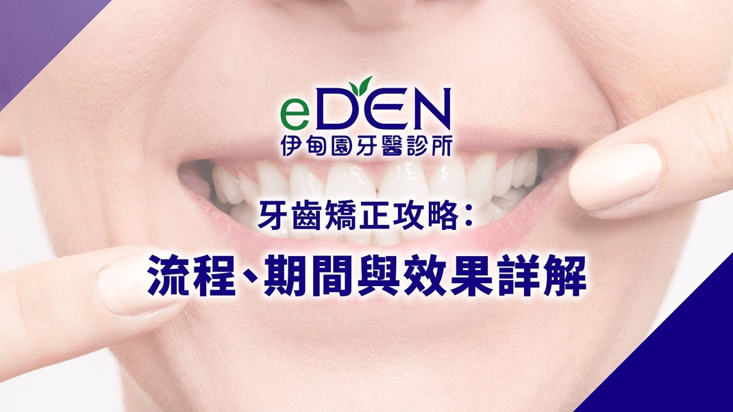 牙齒矯正攻略：流程、期間與效果詳解