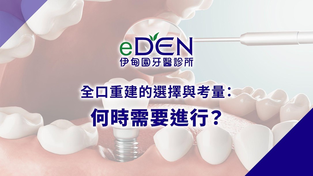 全口重建的選擇與考量：何時需要進行？