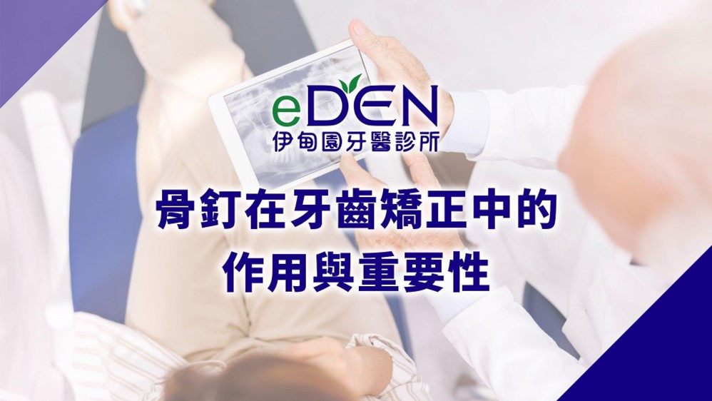 骨釘在牙齒矯正中的作用與重要性